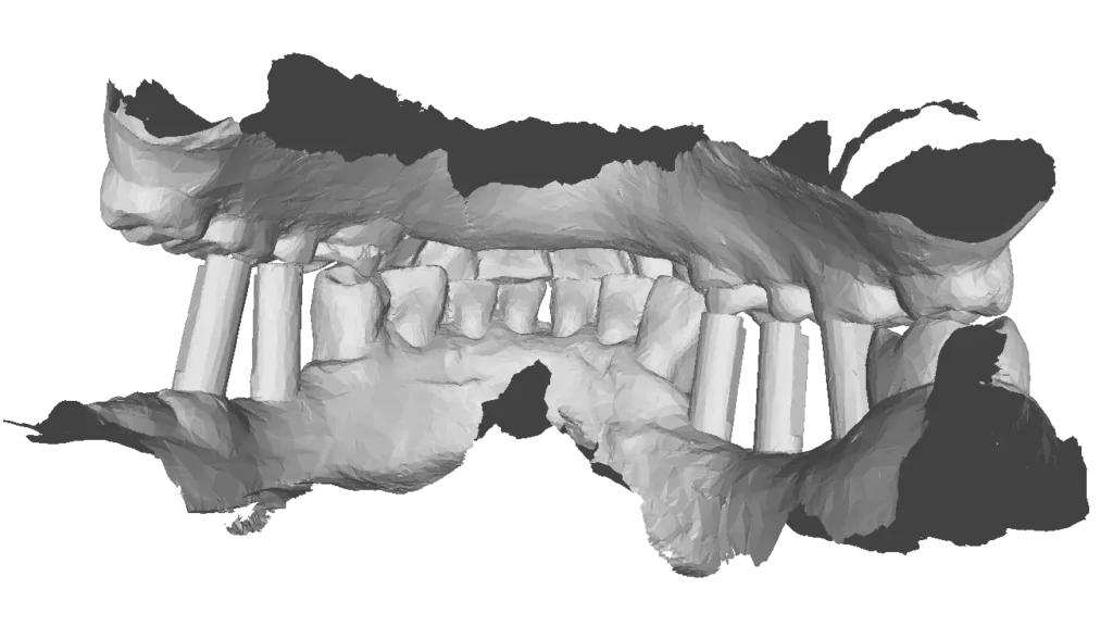 3D Model of a human denture